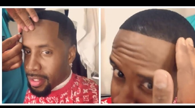 Safaree Samuel transplanting his hair by a doctor
